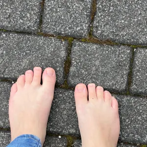 thesunnyfeetice OnlyFans